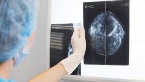 mammografie310122.jpg